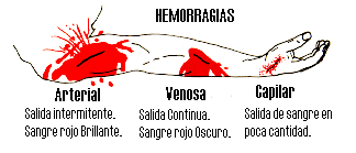 Clasificación de las Hemorragias